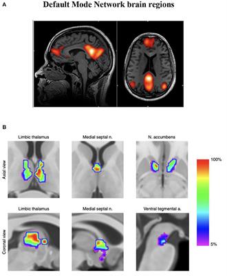 Remediating Intractable Headache: An Effective Nonpharmacological Approach Employing Infralow Frequency Neuromodulation